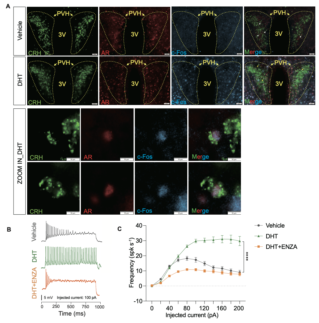 20250325-PNAS-孟雨桐-1. DHT激活CRH神經(jīng)元.png